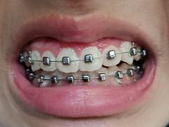 -上海市徐汇区口腔医院