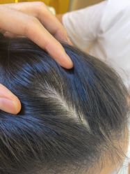 -熙朵美学植发·连锁品牌