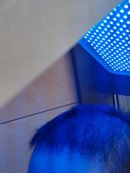 -碧莲盛·不剃发植发