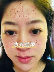 -Yestar艺星整形