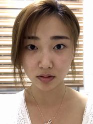 -东莞缔美美容医院