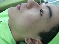 -苗医生草本科技祛痘