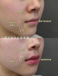 -媛音医美