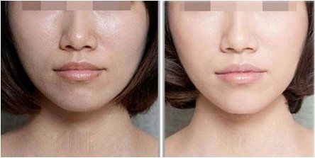 -SKINIST丽铂医疗美容