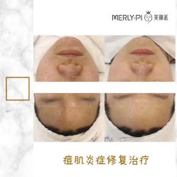-MLP美丽派·问题肌疗愈中心