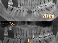 -Dr.Z dental仁康种植矫正中心