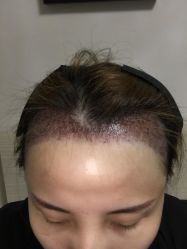 -广东韩妃整形外科医院