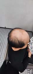 -唐风采假发补发定制
