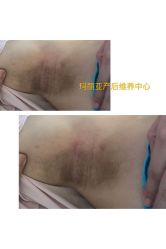 -玛丽亚妇产医院产后修复·医美产康中心