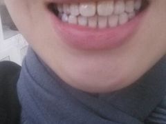 android_upload_pic-岳辰齿科(浦东长泰店)