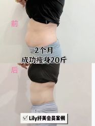 -Lily纤美·科技减脂中心