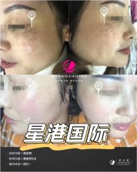 -星港国际·Skin皮肤专研·皮肤管理