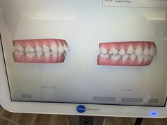 -Dr.Z dental仁康种植矫正中心