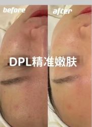 -安吉拉青春化管理中心