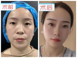 -素美医疗美容·西南眼鼻整形·修复基地