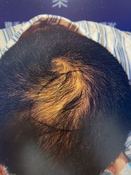 -雍禾植发全国连锁