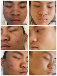 -痘庄科学祛痘国际连锁