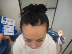 -大麦微针植发丨全国连锁