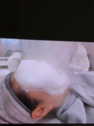 体验前-SKIN79皮肤管理中心