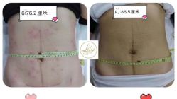 -Lily纤美·科技减脂中心