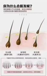 -希梵尔头皮抗衰·科技养发