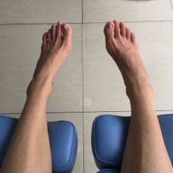 -德哥灰指甲脚气甲沟炎跖疣护理