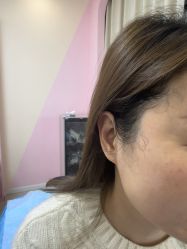 -长沙雅美医疗美容医院