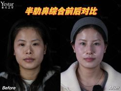 点击看大图 -Yestar重庆艺星医疗美容医院