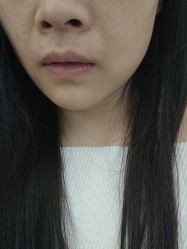 -长沙雅美医疗美容医院