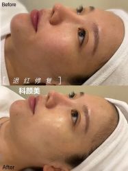 -美肤盾祛痘·问题肌头疗管理中心