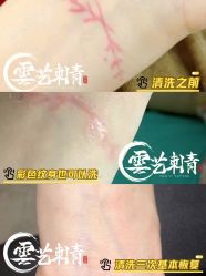 -雲艺刺青·洗纹身