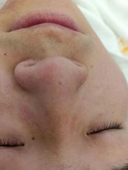 -蕾特恩专业祛痘·皮肤管理