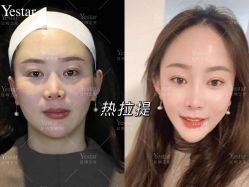 -Yestar艺星医疗美容医院