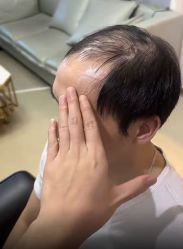 -唐风采假发补发定制