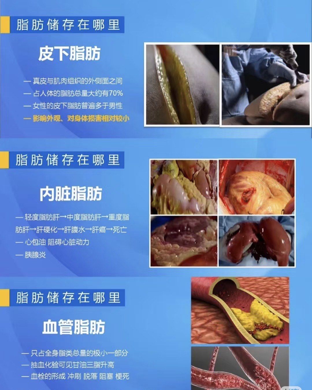 脂肪大量排出的表现(吃什么代谢快又容易瘦)