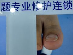 -Andrew指甲专科灰指甲·甲沟炎矫正·3D步态矫形鞋垫定制(浦三路店)