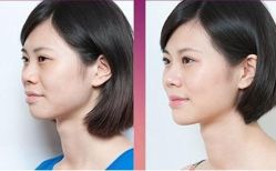 点击看大图 -SKINIST丽铂医疗美容