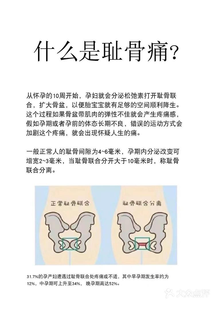 32 关注 孕期耻骨痛不用慌,三个动作帮你缓解疼痛 孕期碰上了耻骨疼