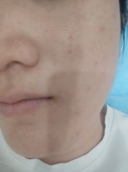 -北京英煌医疗美容·轻颜六区注射修复