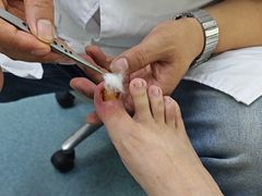 -新甲连锁灰指甲·甲沟炎·鸡眼(黑龙江路店)