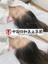 点击看大图 -西施无菌半永久纹绣眉眼影唇轻增发纹发际线