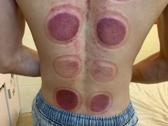 -安琪盲人按摩调理草本熏蒸馆(风和日丽店)