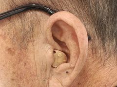 -安湃声助听器(密云店)