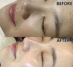 -SKIN79皮肤管理中心