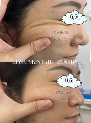 -KISS U 国际美学