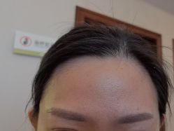 -长沙雅美医疗美容医院