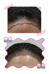 -熙朵美学植发·连锁品牌