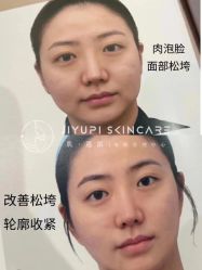 -MLP美丽派·问题肌疗愈中心