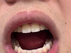 -宁波壹加壹口腔·矫正种植中心