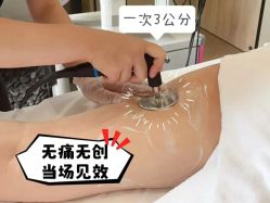 -Fundi张玉珊修身堂·indiba·BTL科技瘦身